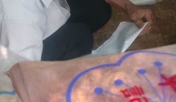 Mua bán nhau thai người: Chủ yếu là hàng Trung Quốc